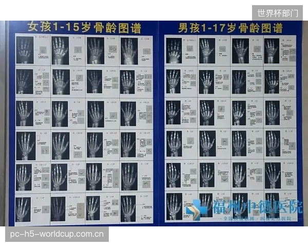 上海市儿童医院的AI骨龄辅助诊断系统，正将专业医疗报告转化为俱乐部能理解的选材建议